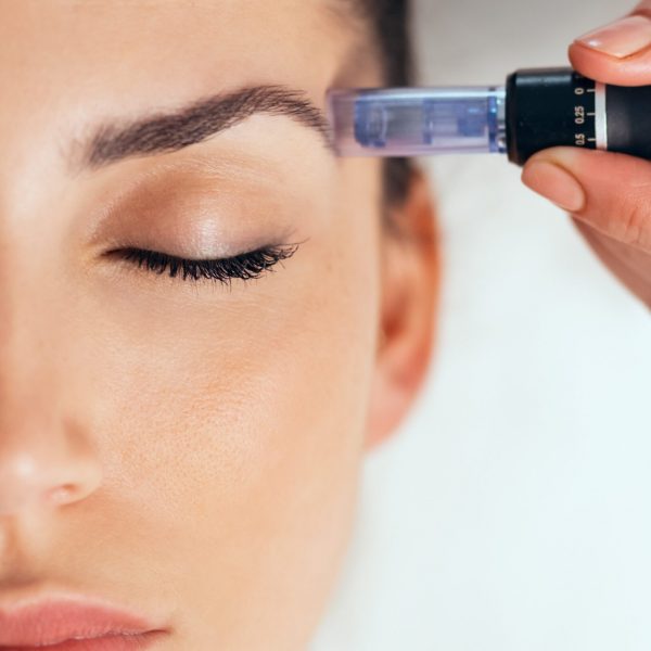 SkinPen Microneedling Face Scottsdale